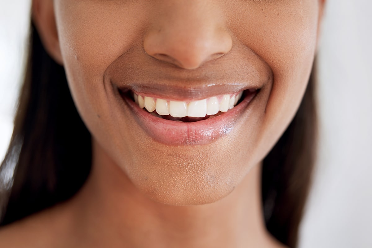 Porcelain veneers in north andover how they instantly improve your smile blog